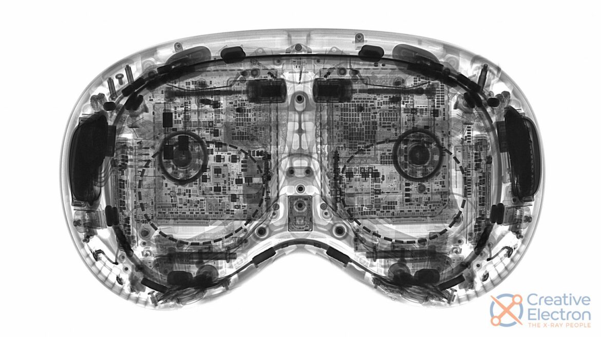 AVP-Xray-2048×1150